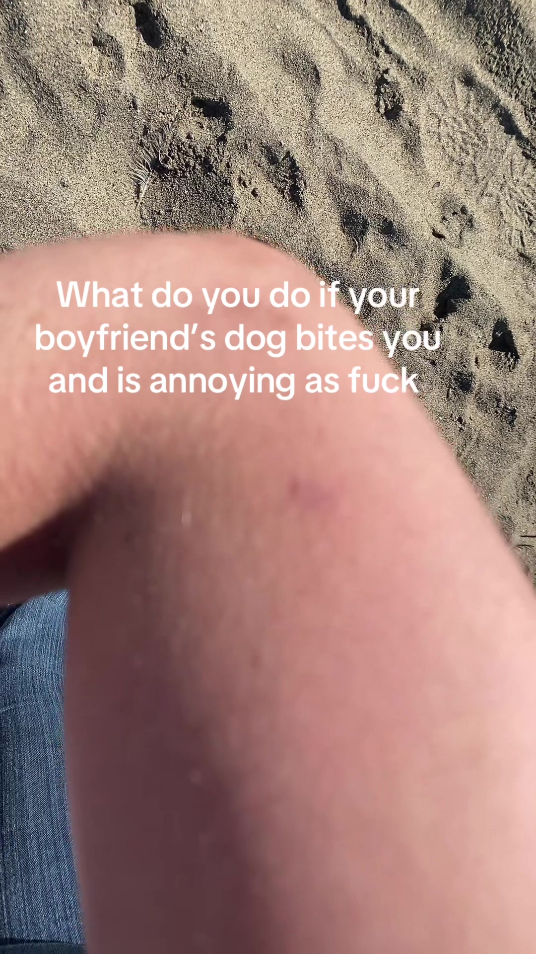 @Brikell Burns