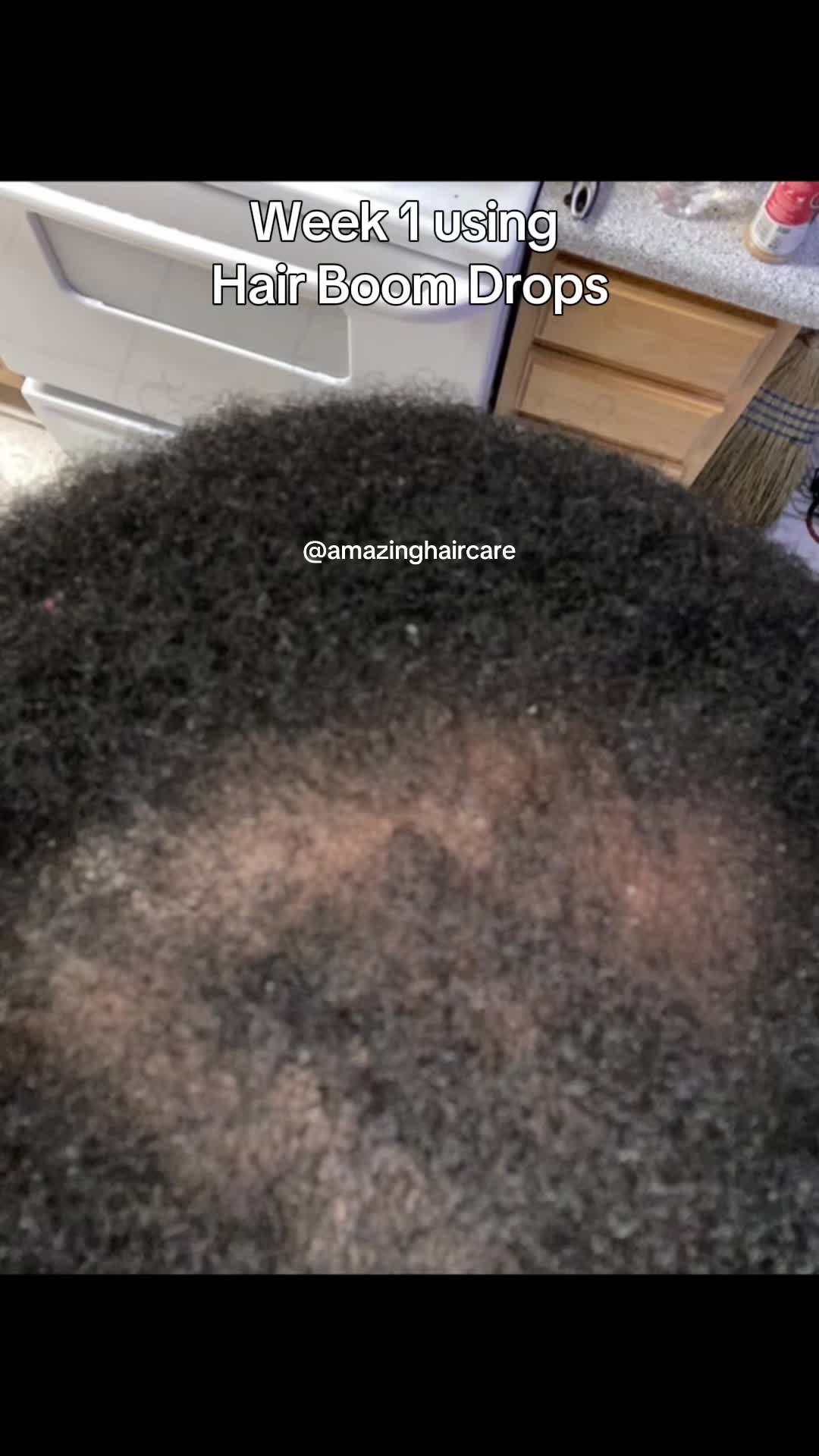 @Amazing Hair Care