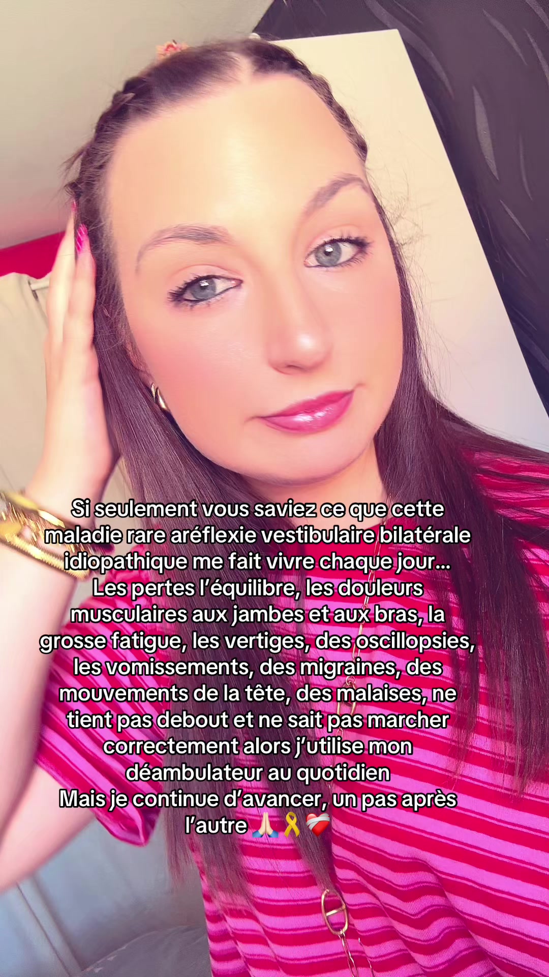 @Ꮮ Ꭼ́ Ꭺ 🎗️