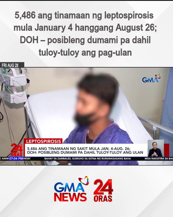 @24 Oras