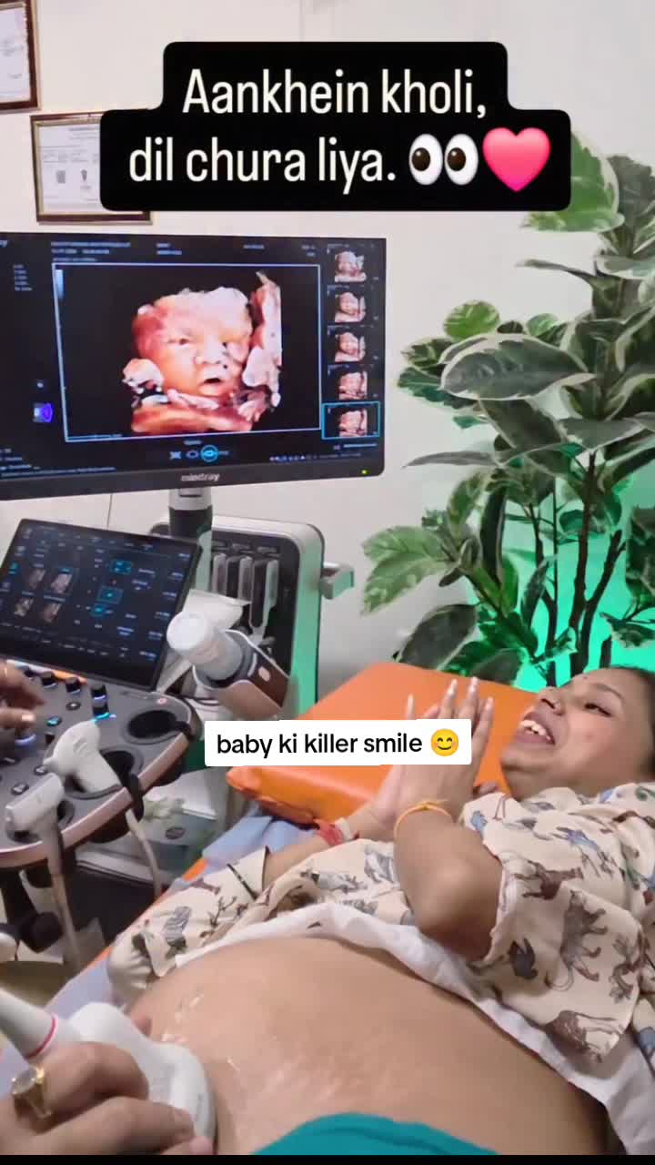 @Alina