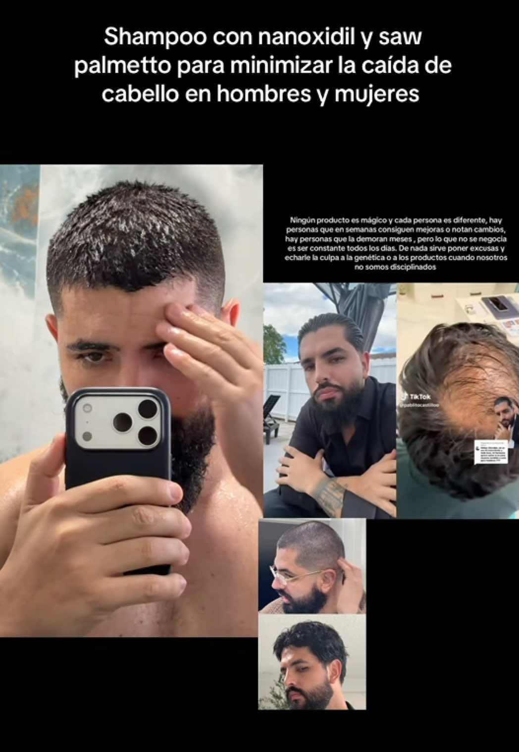 @Gonzalo Costa
