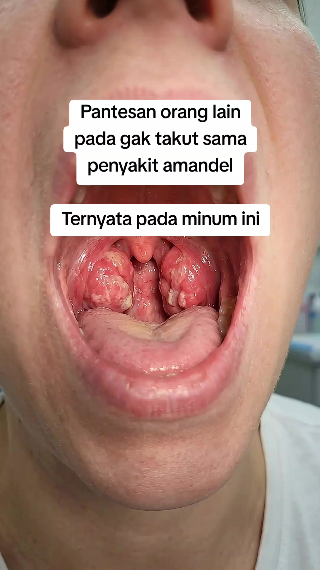 @Mitana Herbal