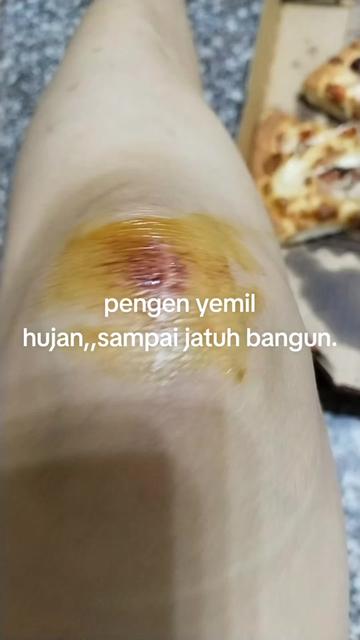 @Ziaucen Putri Mss