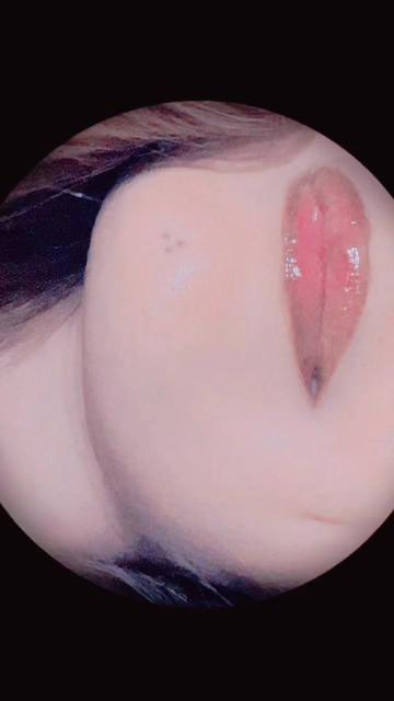 @Dimple girl😜