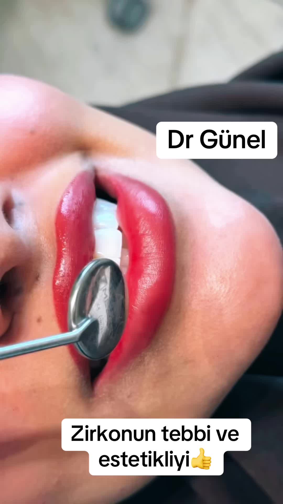 @Dentist_Günel
