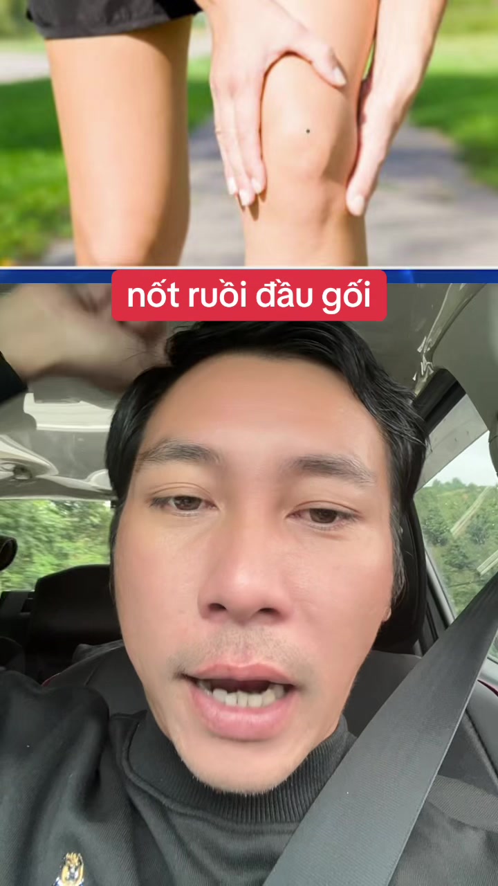 @Tuệ Nhãn ✅