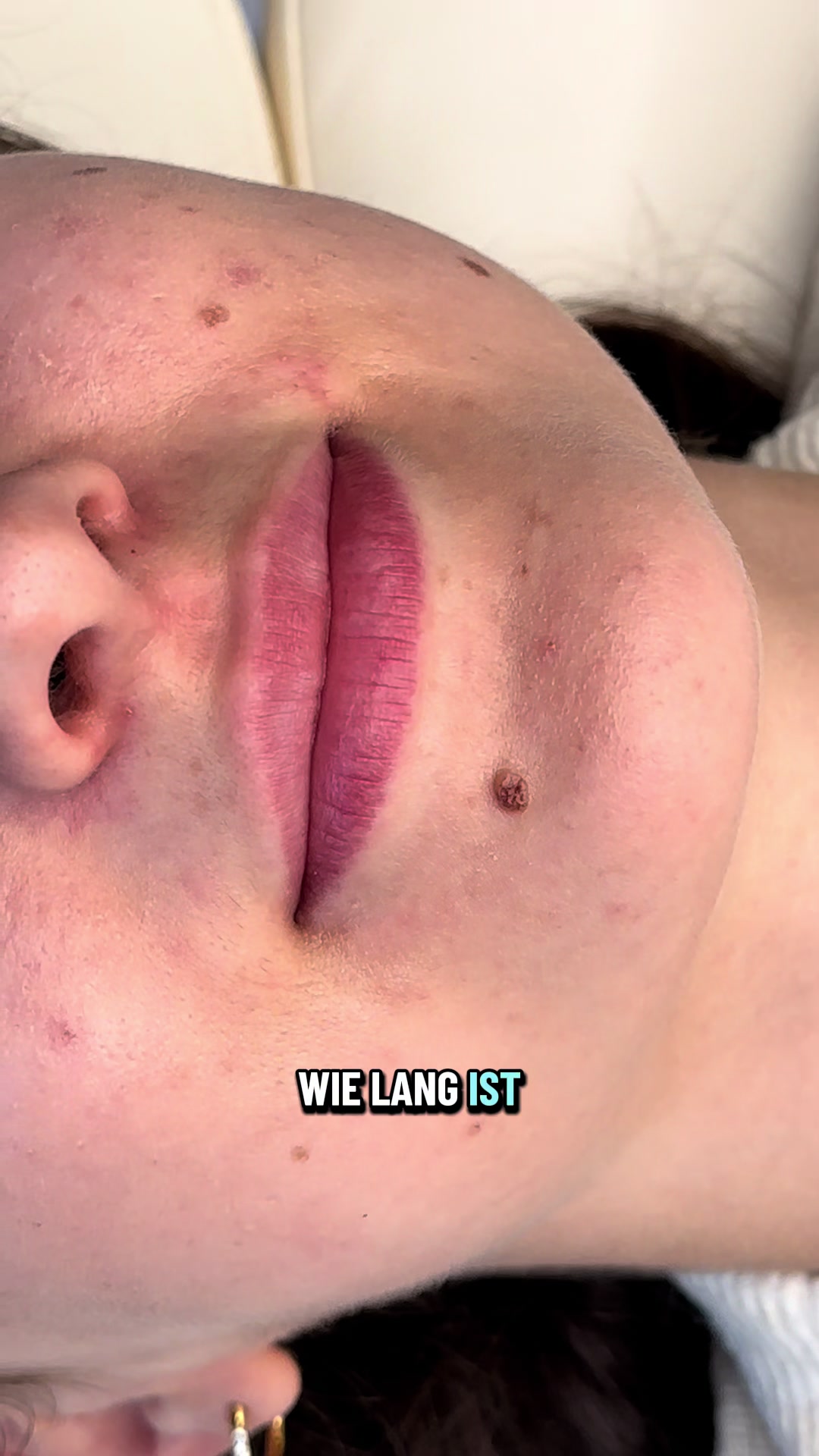 @jonas__vitalis