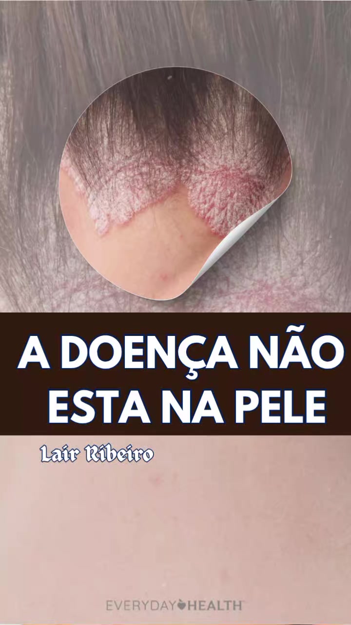 @Viva melhor