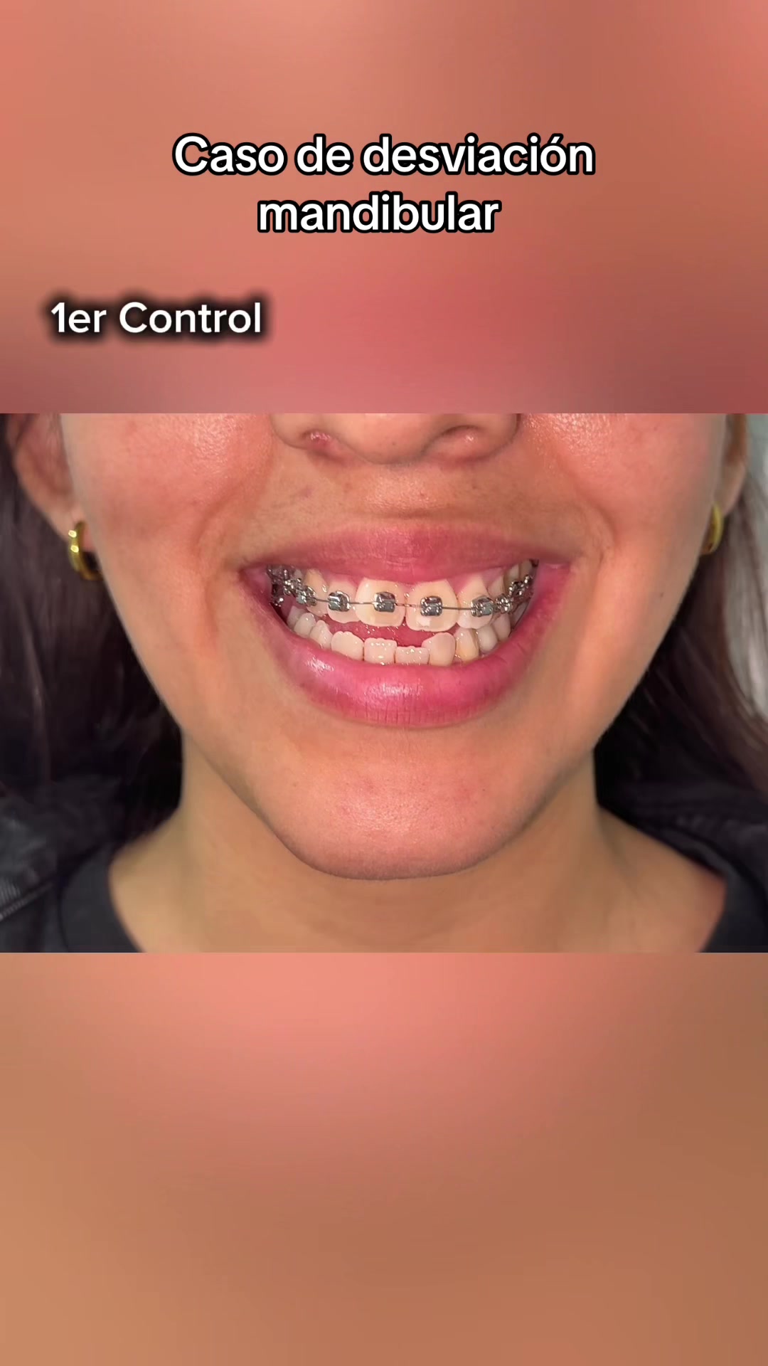 @DentikaBrackets