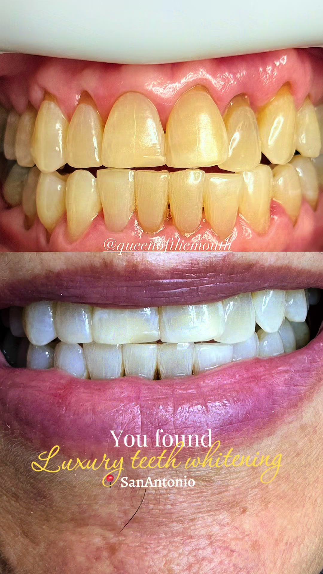 @Queenofthemouth