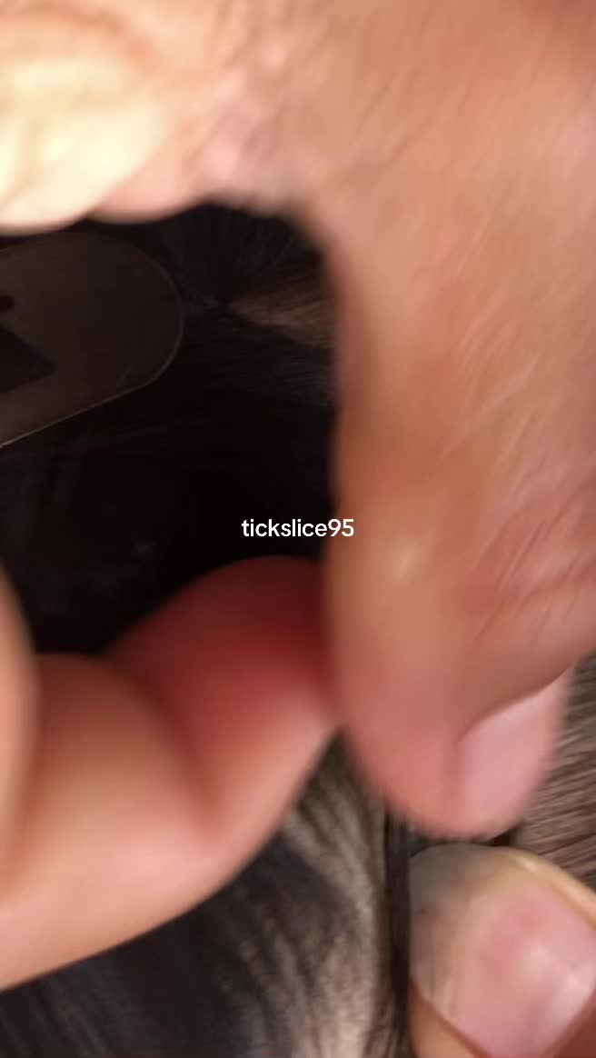 @Tickslice95