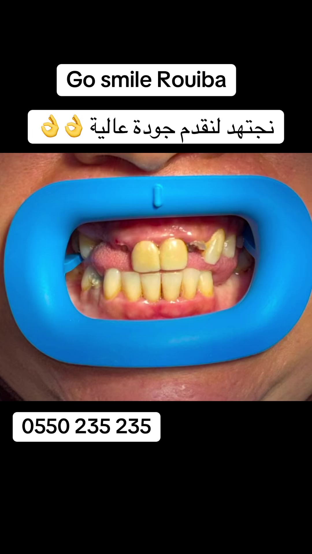 @GOSMILE ROUIBA🇩🇿