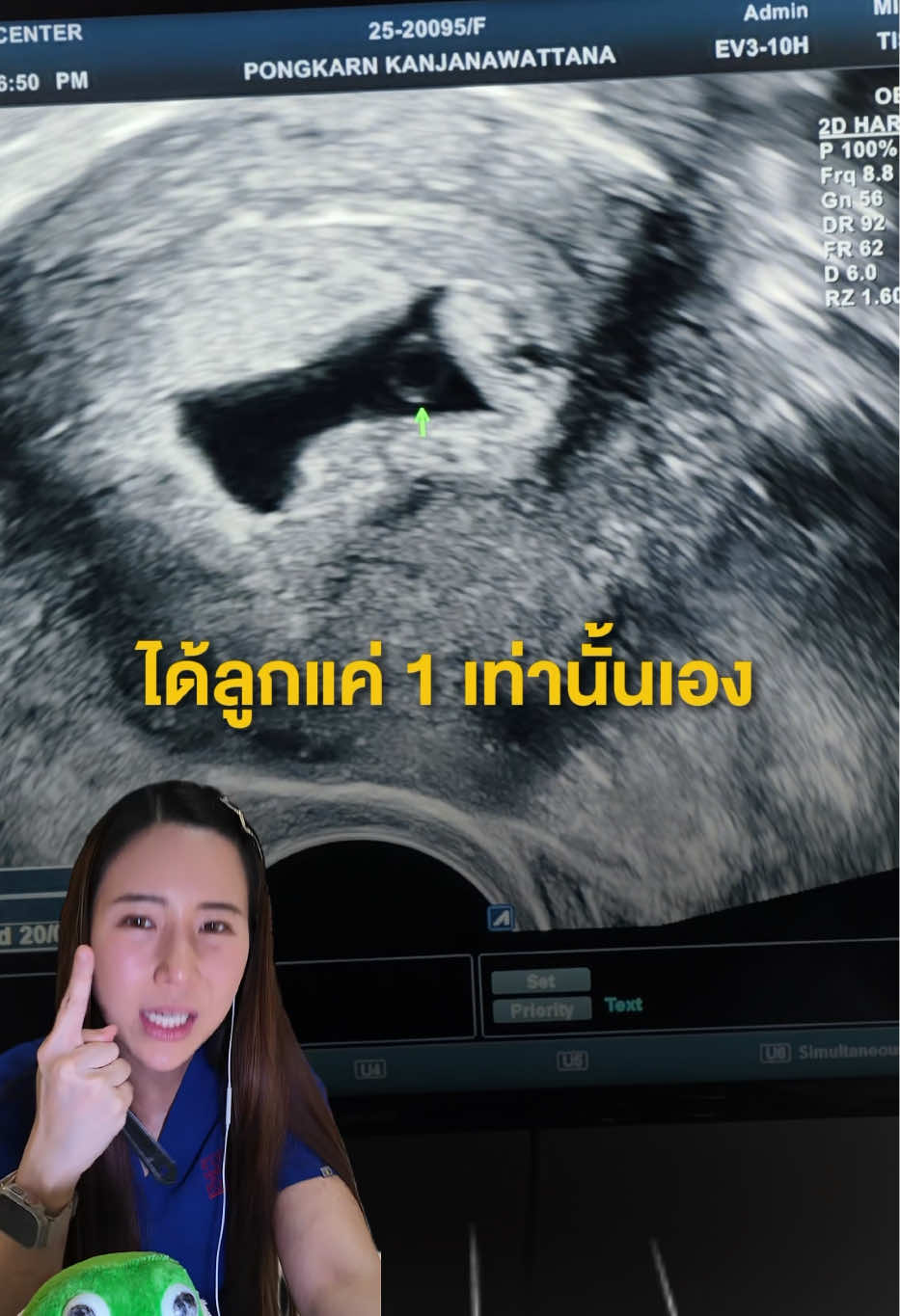 @หมอป่องสวยมาก veneer 🦷