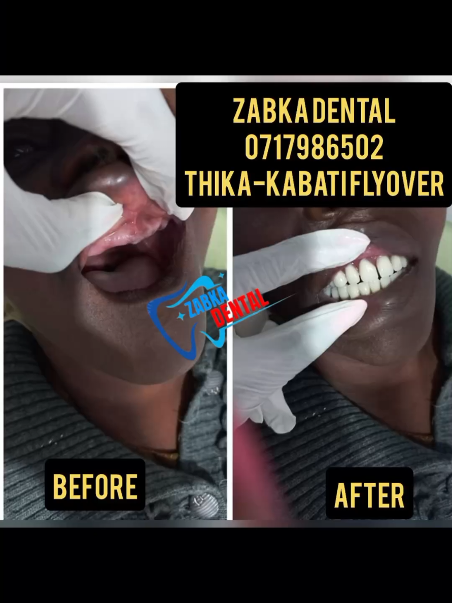 @Zabka Dental