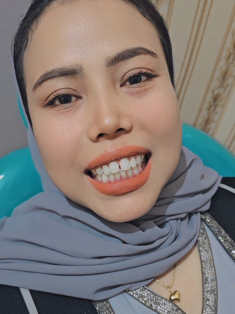 @fiqy gigi