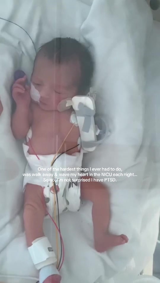 @zoeandherpreemies