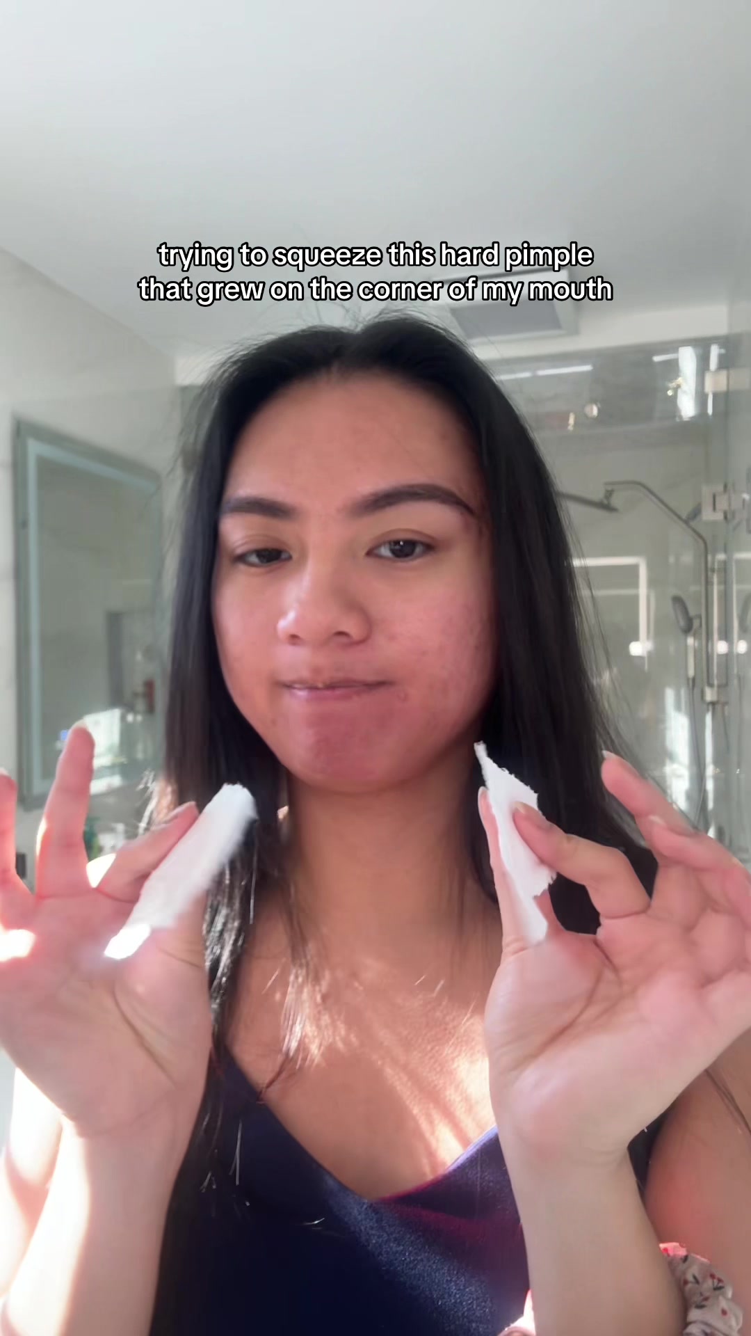 @jennilee • thatacnegirlie