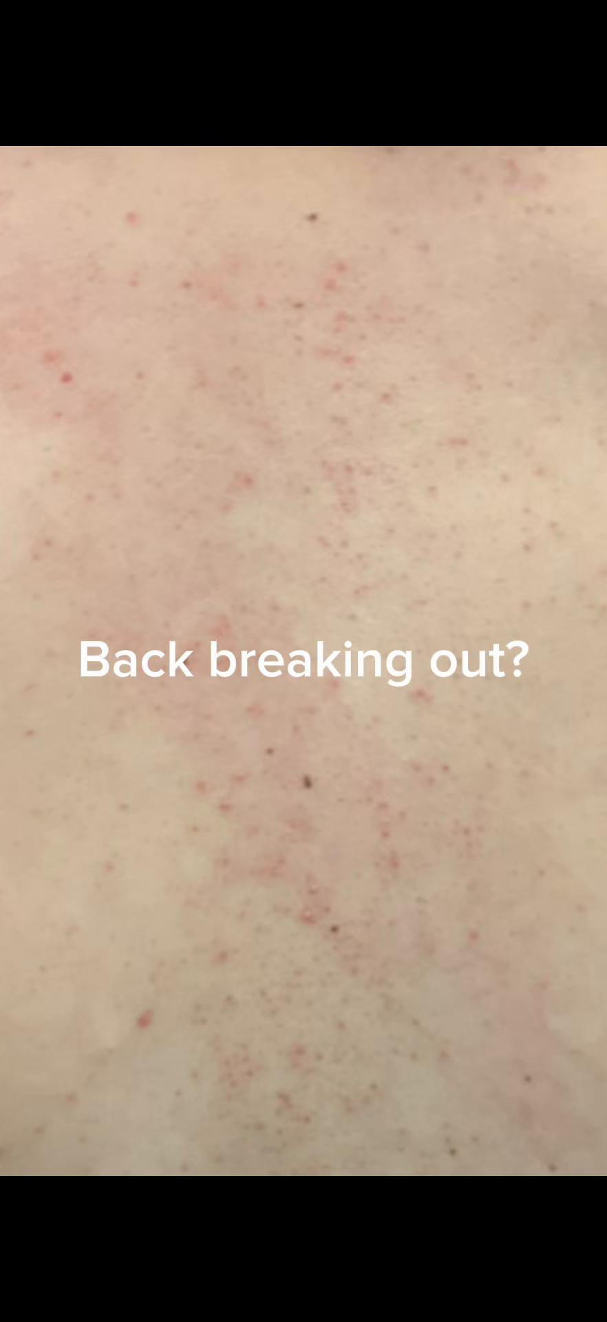 @Rosedermnyc