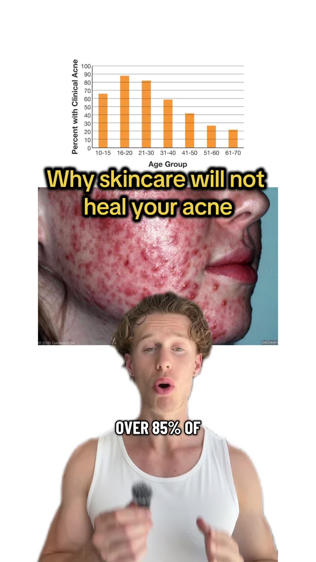 @Timo H