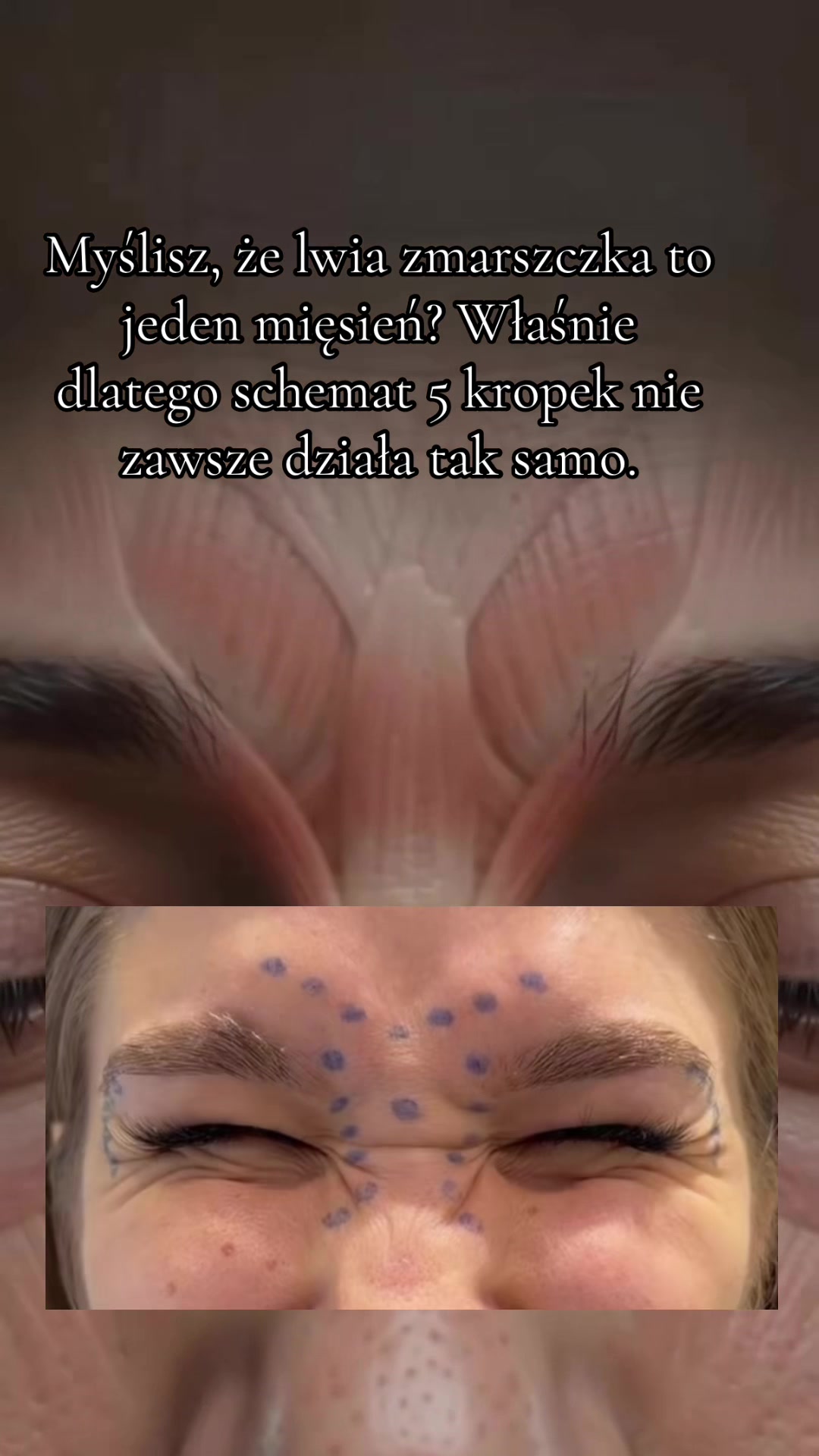 @Monika Sekita-Pilch