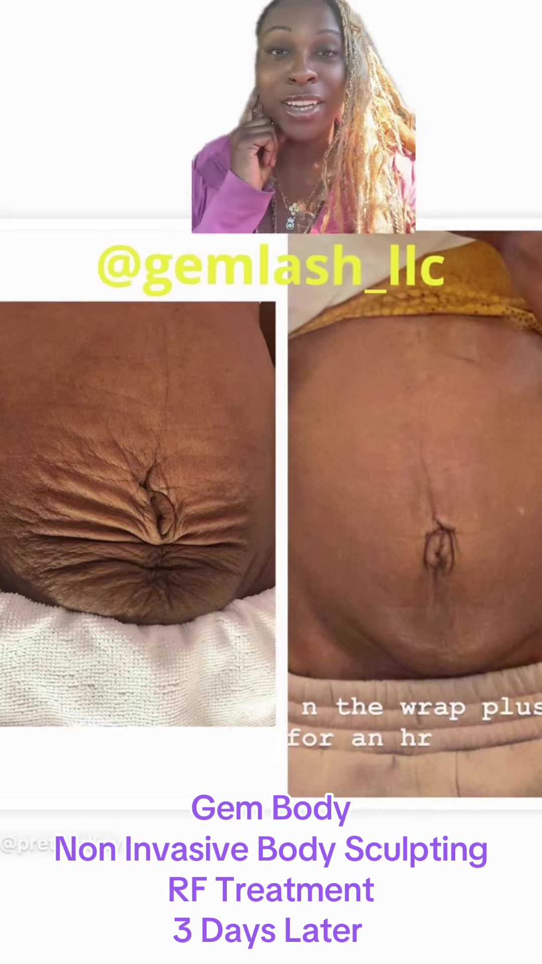 @Gem Lash Gem Body