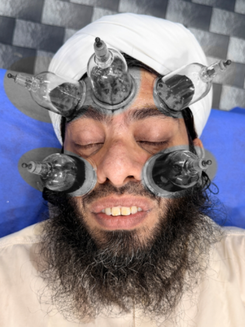 @Doctor & Hijama Cupping Clinic