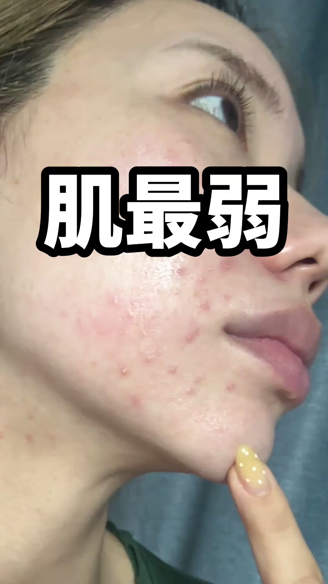 @肌最弱ゆい🇰🇷韓国在住