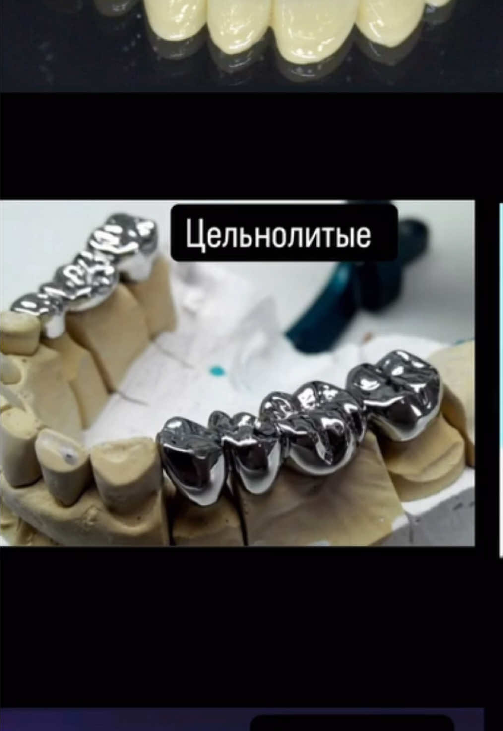 @Dent_tooth