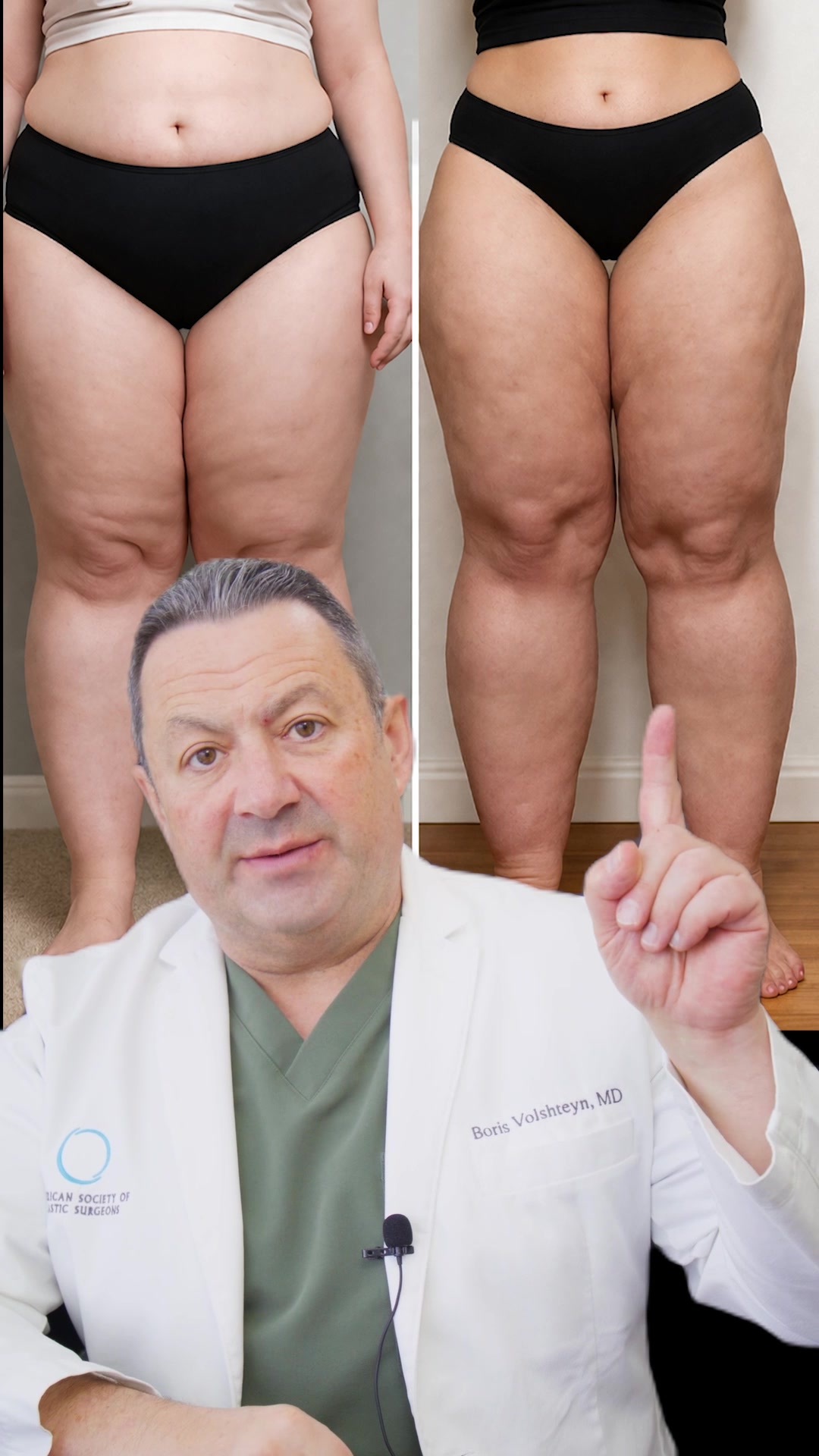 @BorisMD