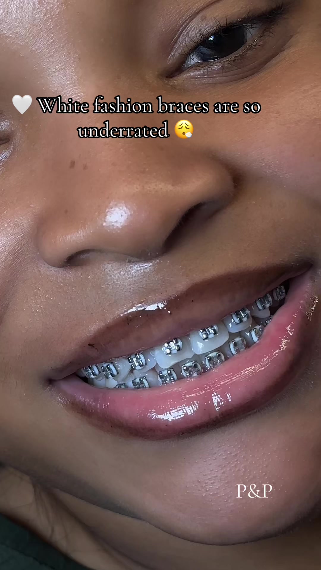 @AGO PALACE LASH&BRACES ARTIST