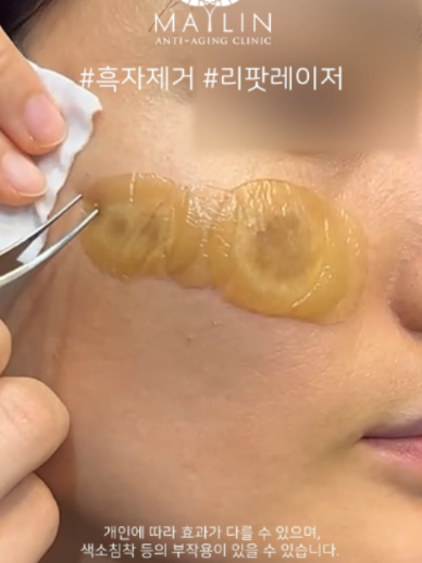 @메이린의원대구점