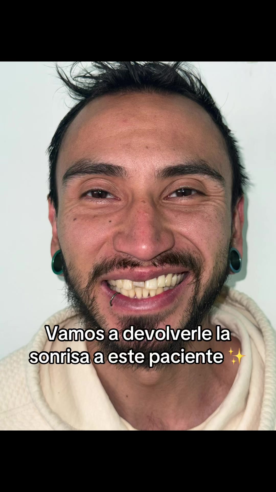 @GabeApreza