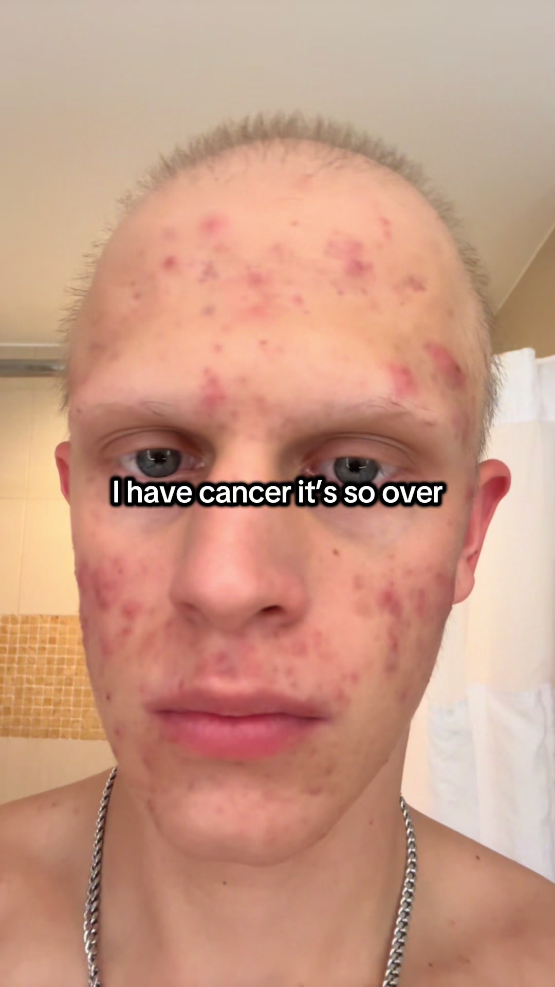 @Trace🎗️