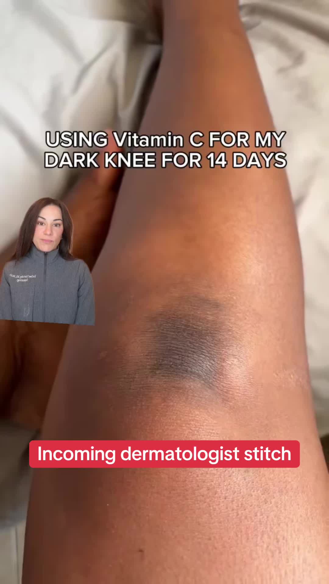 @Dermguru