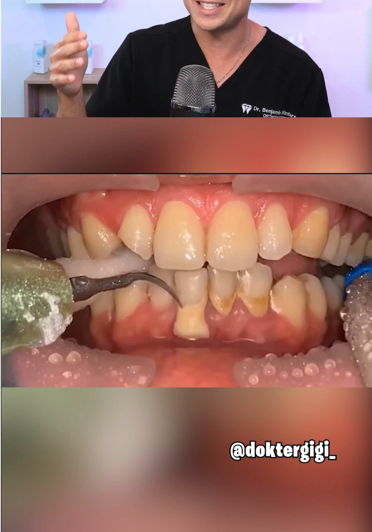 @Thebentist