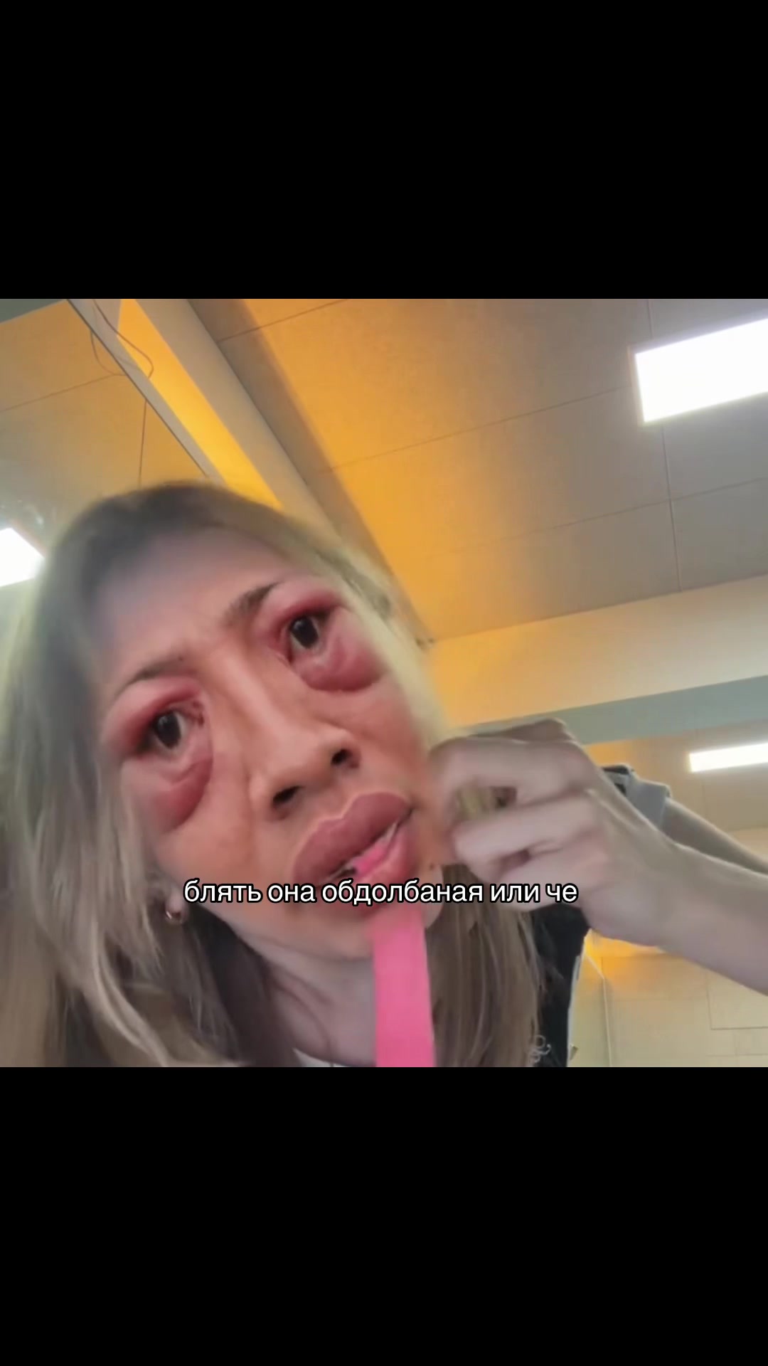 @3xs