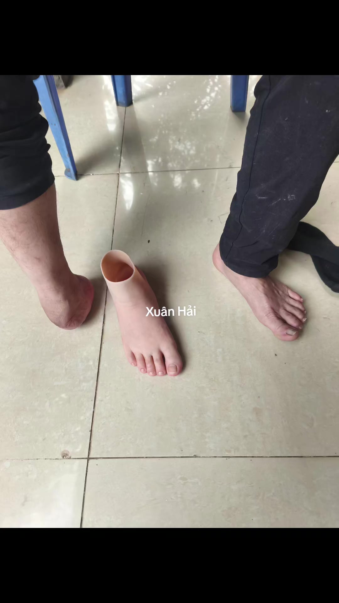 @Hải Râu Tay Chân Giả