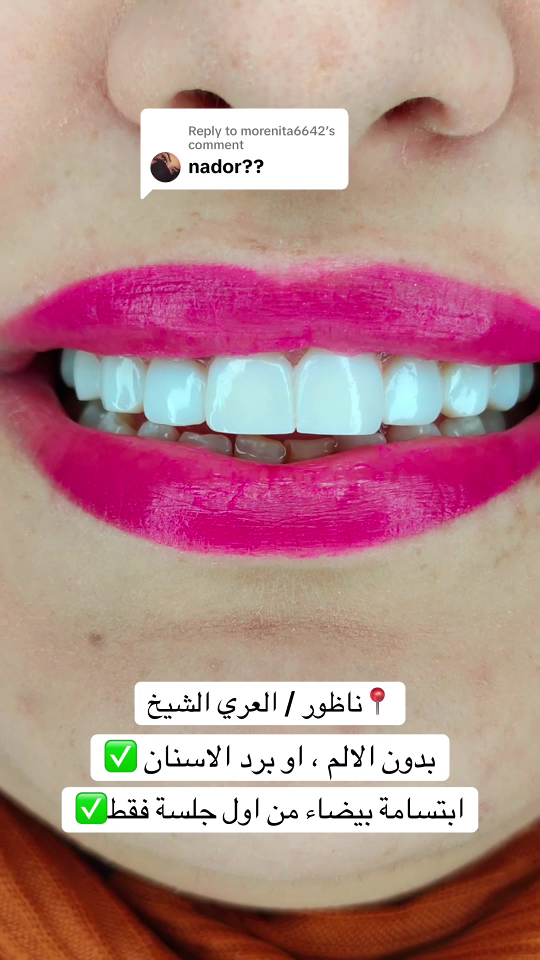 @brightsmileee1