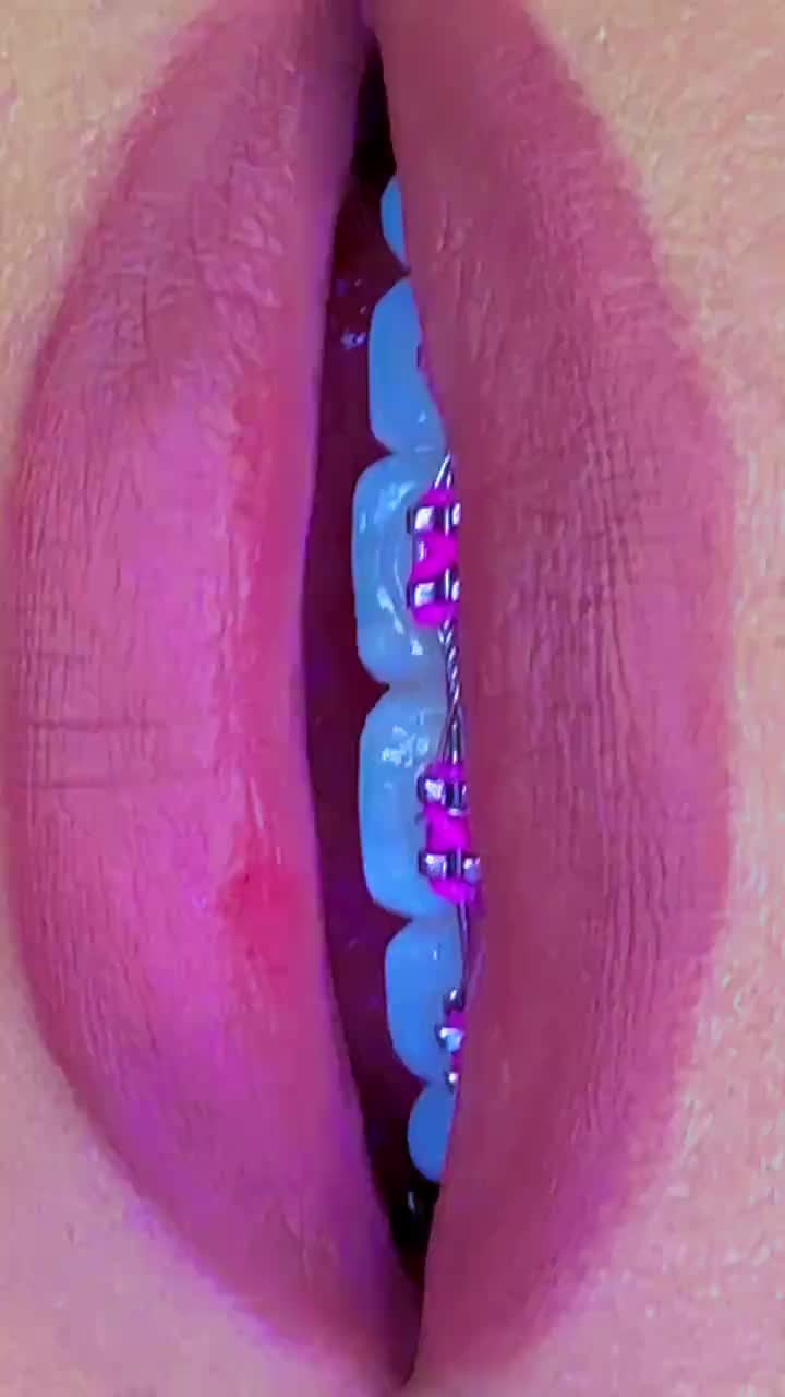 @Syncy