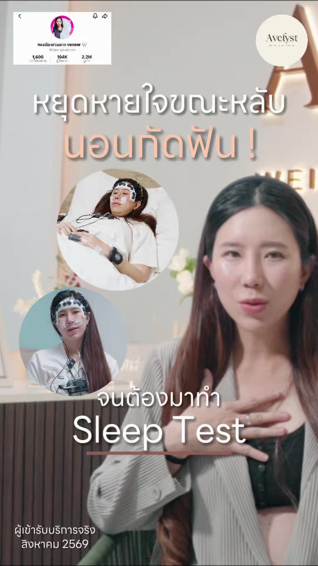 @หมอป่องสวยมาก veneer 🦷