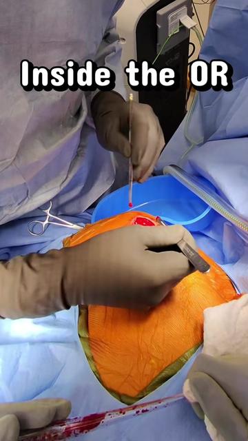 @Ortho POV