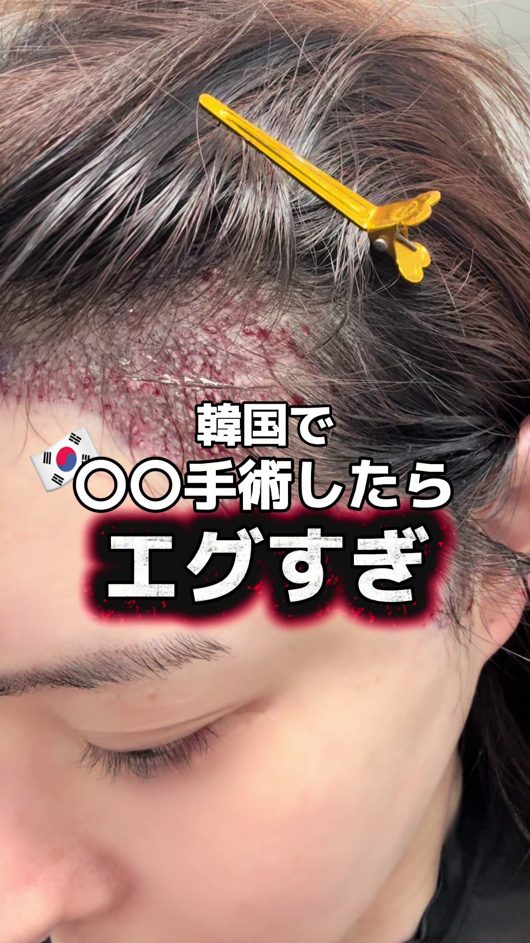 @ぼっちな韓国オタク🇰🇷みちゃん