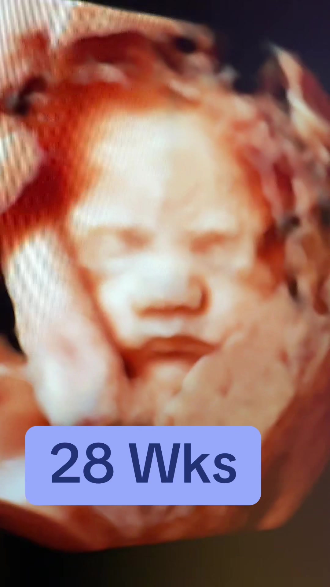 @PregnantSee Inc.