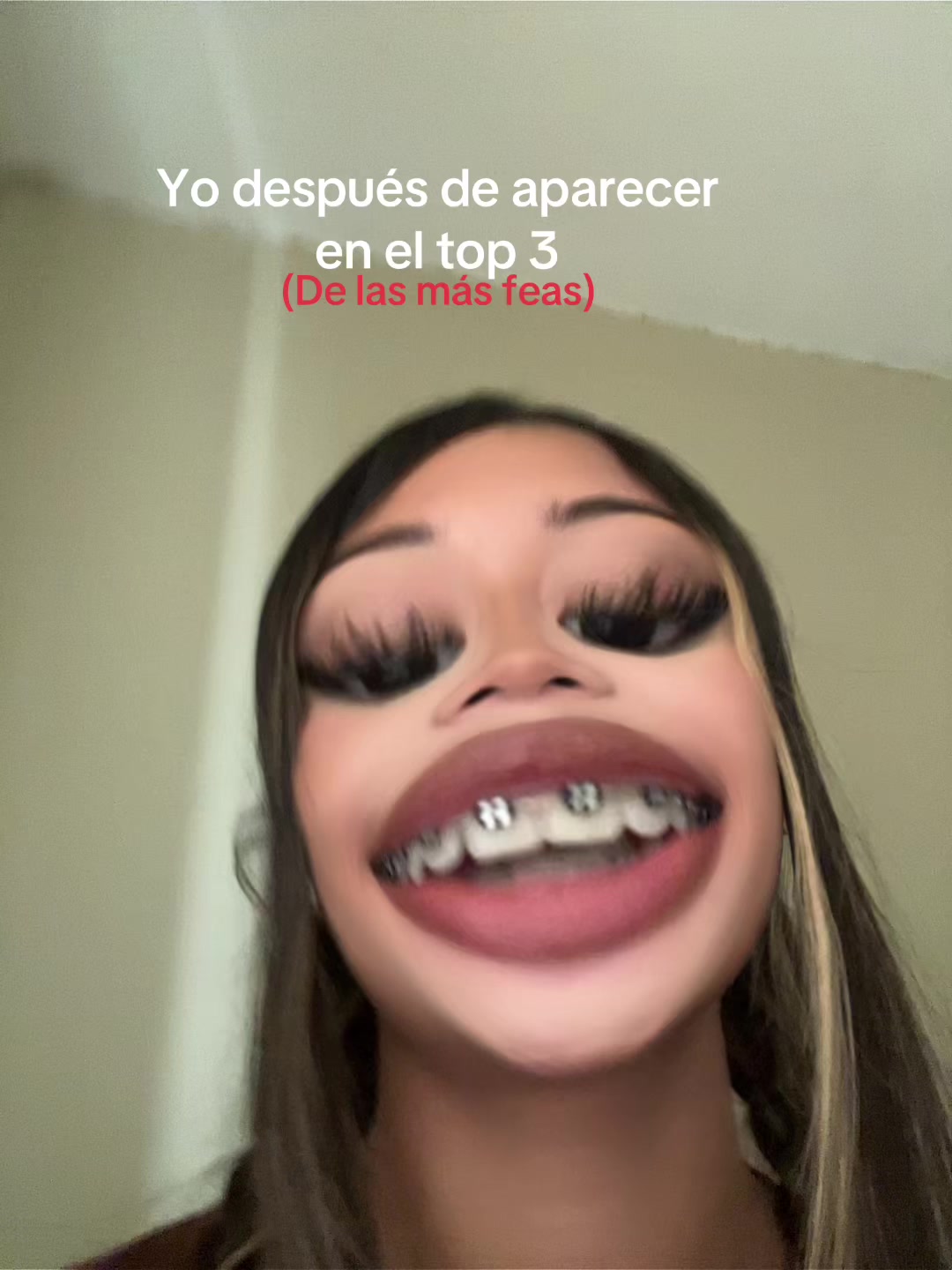 @vpo
