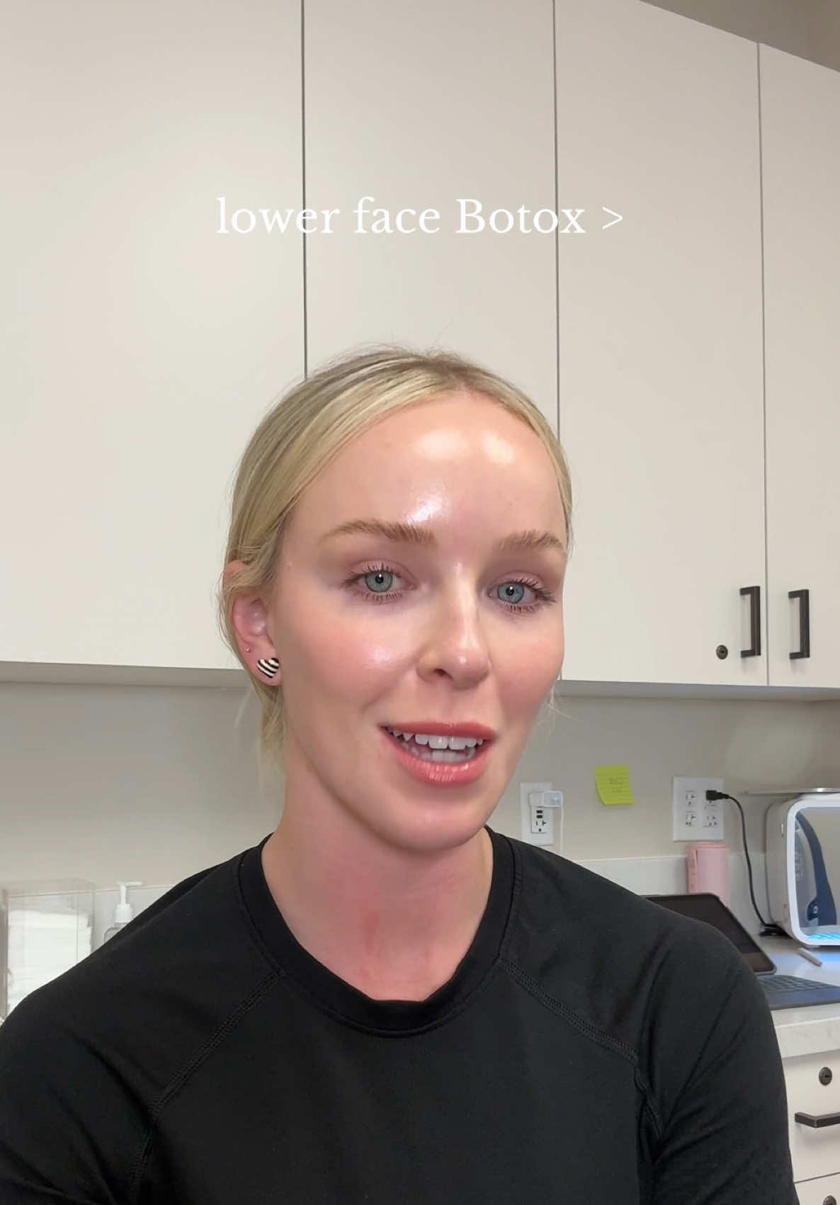@Lindsay|Arizona Nurse Injector