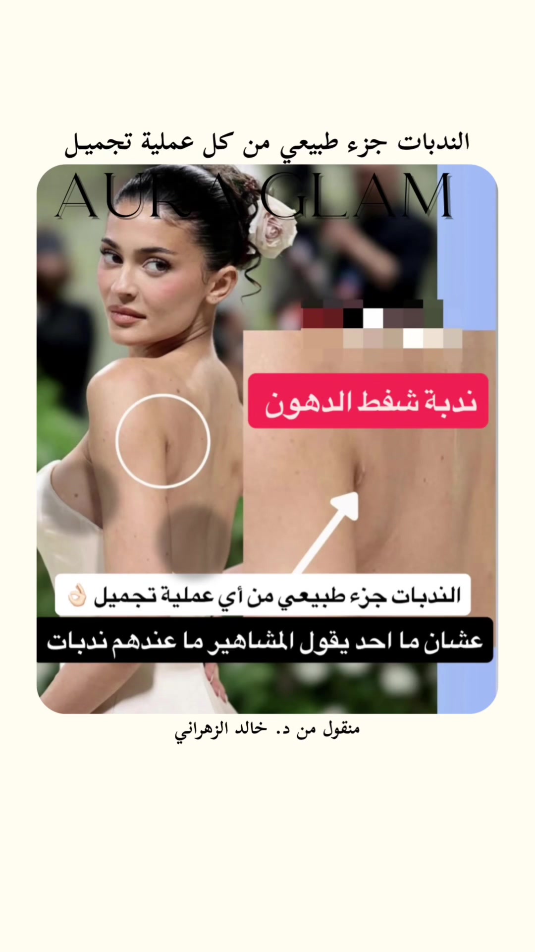 @AURA GLAM | أورا قلام