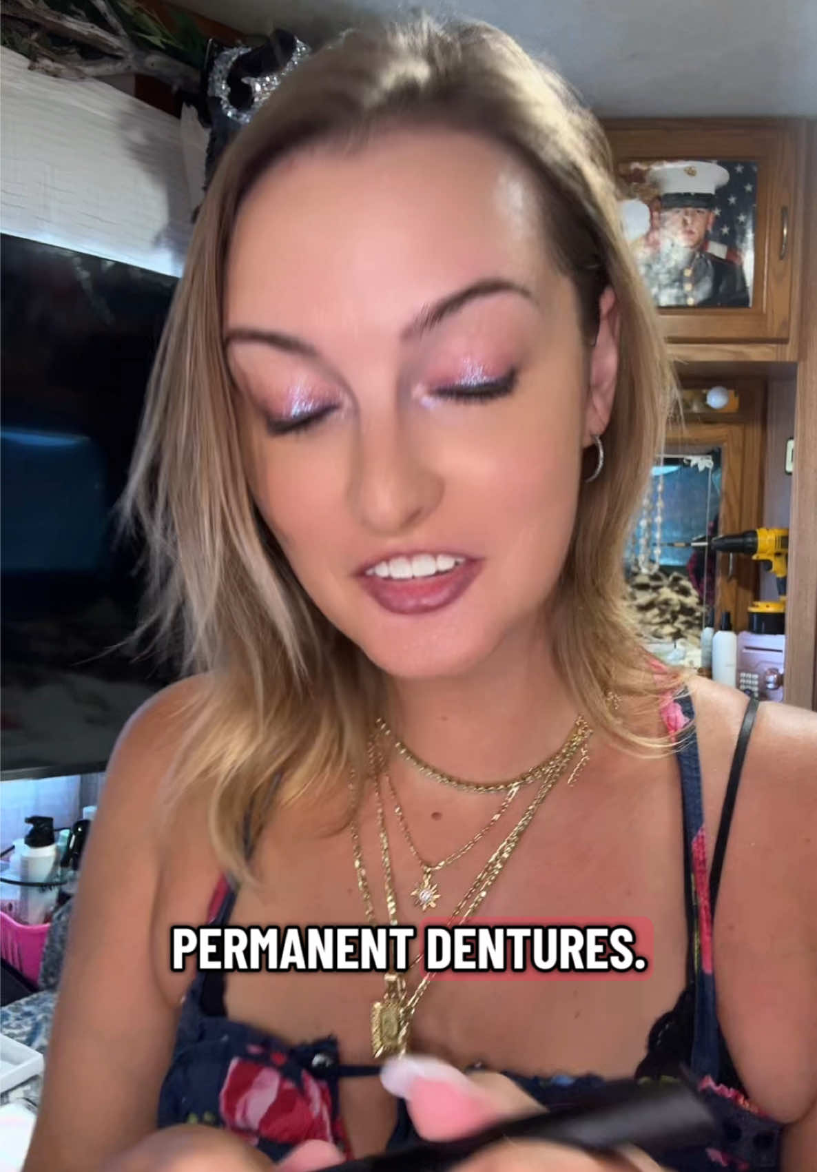 @Sarah | Dentures | UGC | RVing