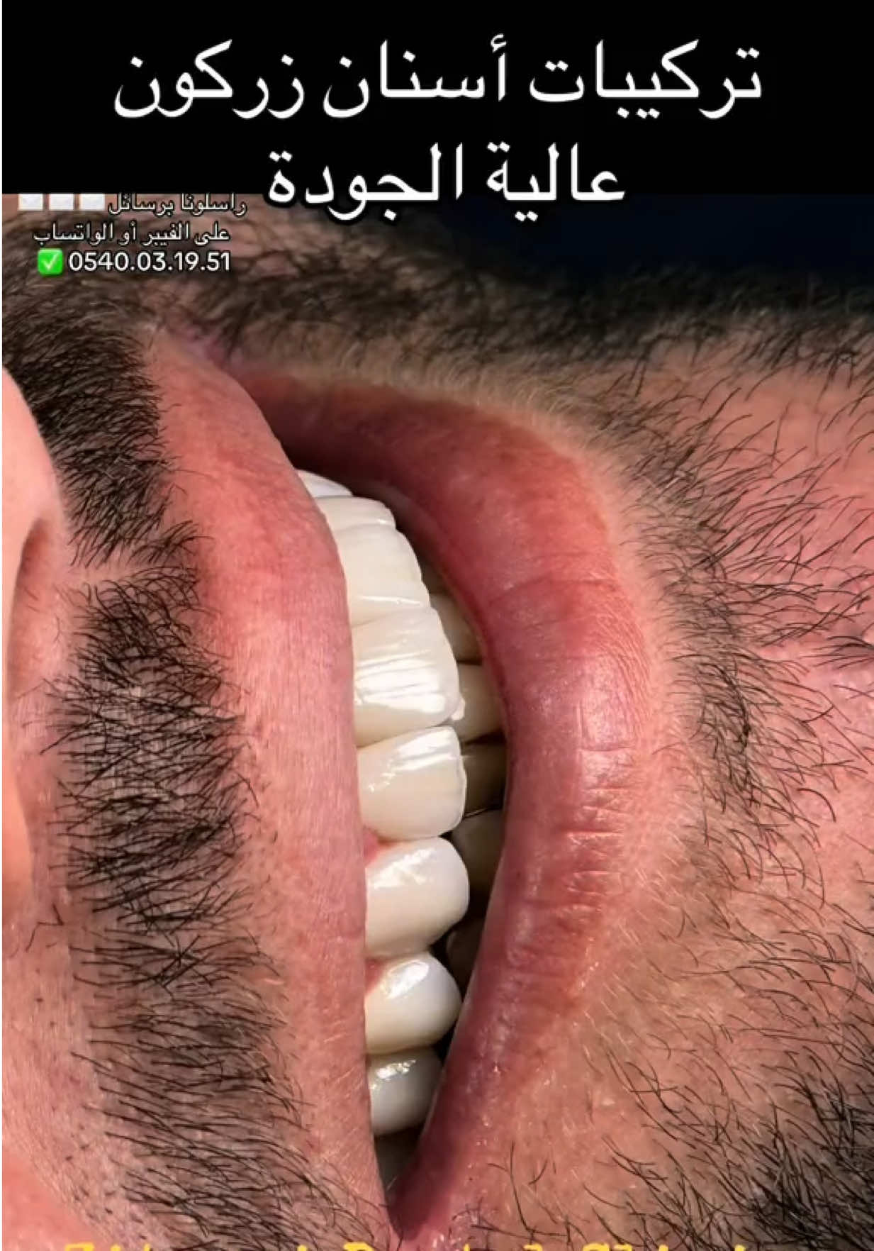 @Docteur Zitouni