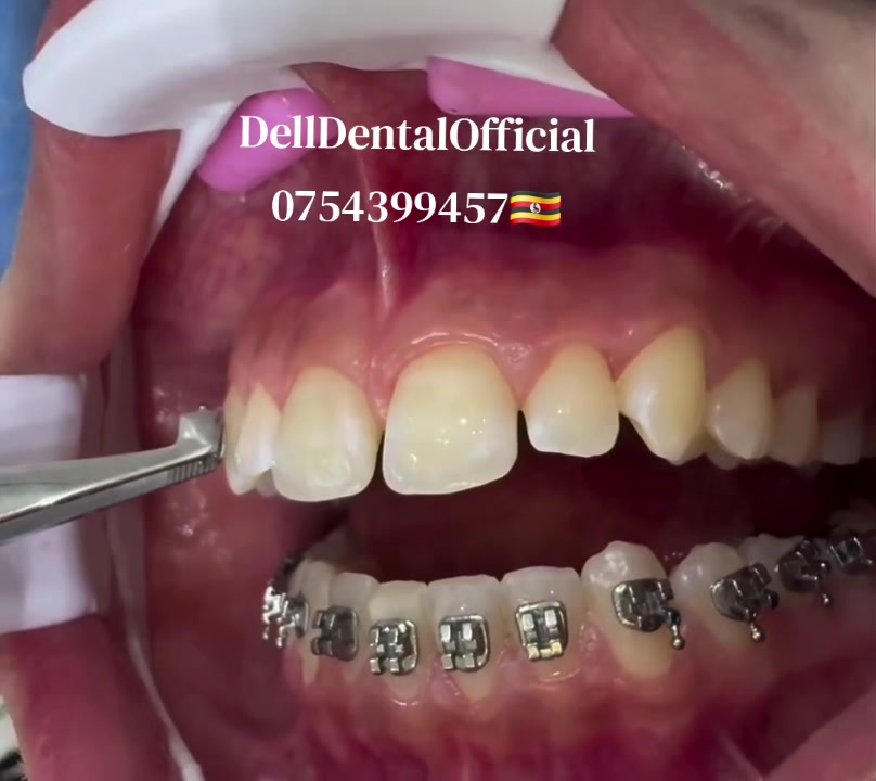 @DellDentalOfficial